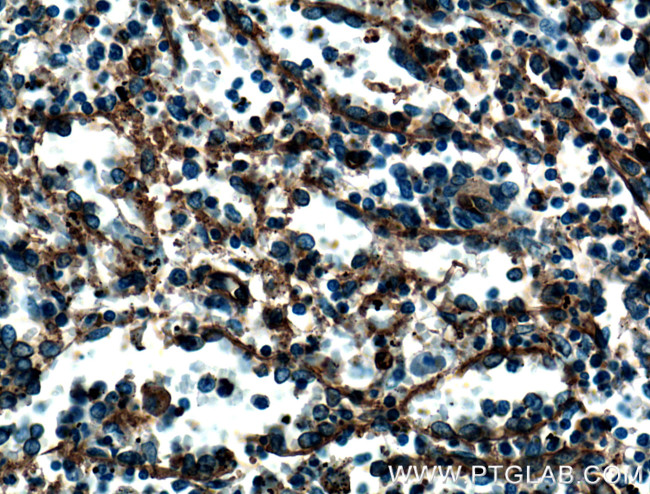 CD36 Antibody in Immunohistochemistry (Paraffin) (IHC (P))