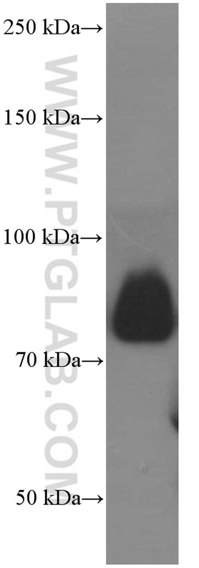 CD36 Antibody in Western Blot (WB)