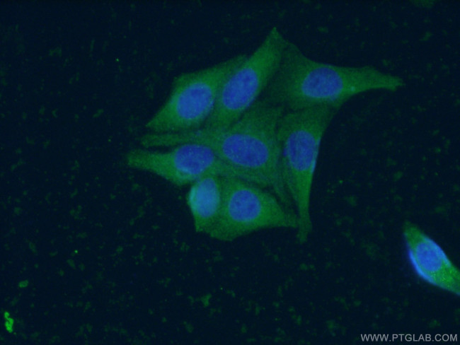 ZC3HAV1 Antibody in Immunocytochemistry (ICC/IF)