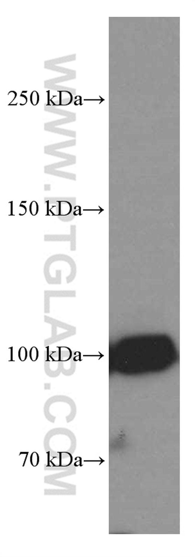 ZC3HAV1 Antibody in Western Blot (WB)