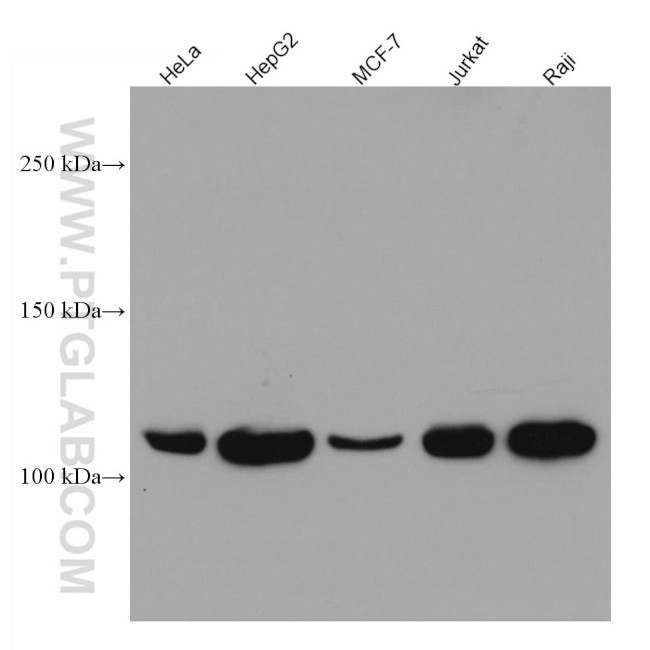 LDLR Antibody in Western Blot (WB)