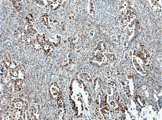 FOXO3A Antibody in Immunohistochemistry (Paraffin) (IHC (P))