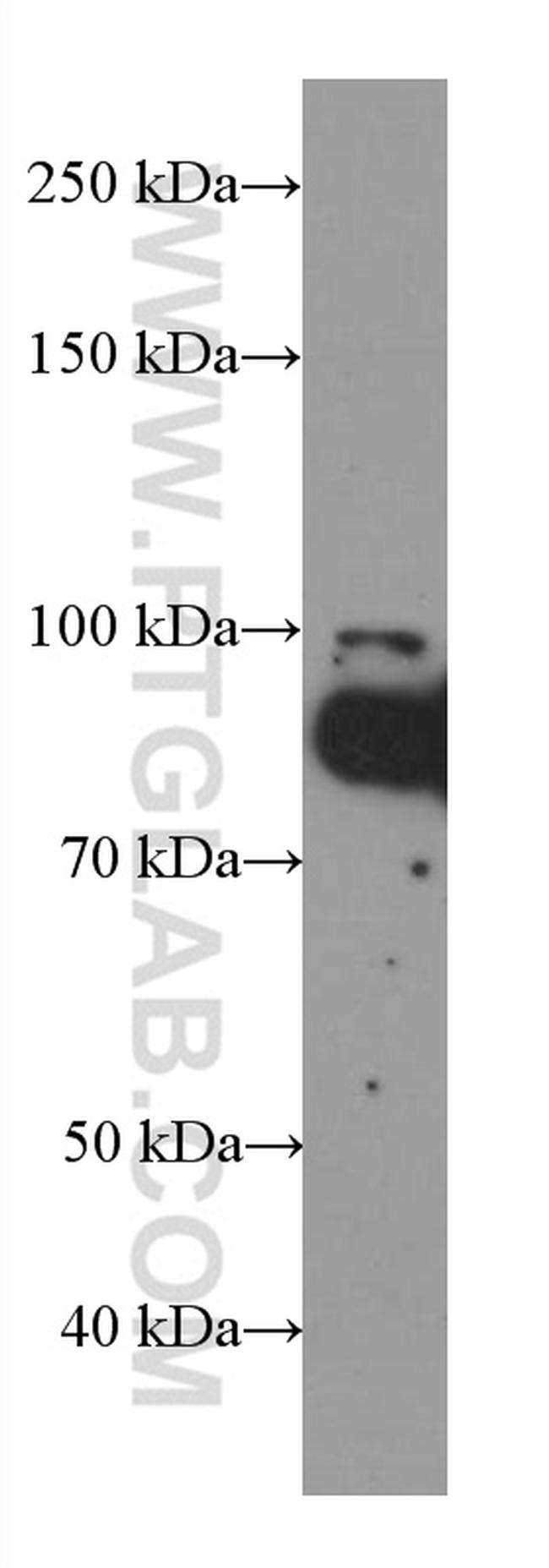 FOXO3A Antibody in Western Blot (WB)