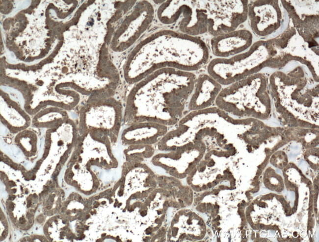 COPS2 Antibody in Immunohistochemistry (Paraffin) (IHC (P))