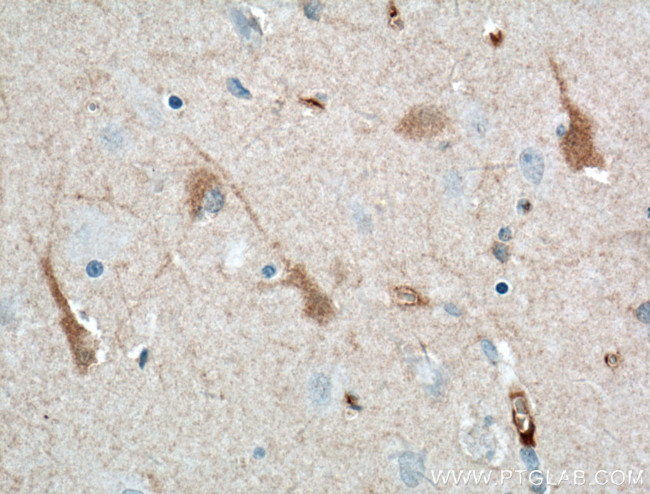 KChIP1 Antibody in Immunohistochemistry (Paraffin) (IHC (P))