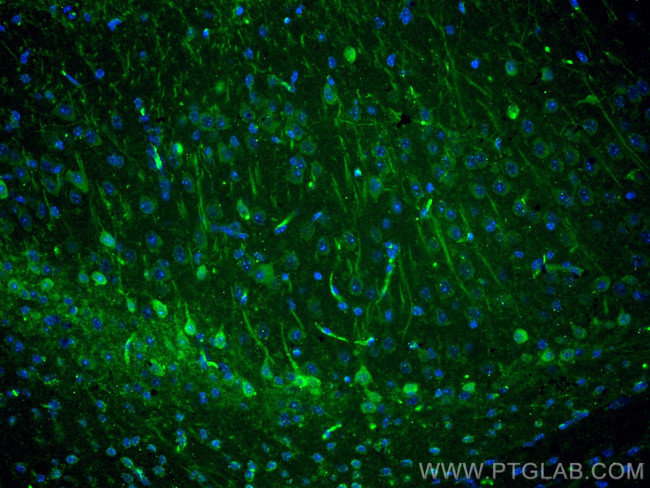 KChIP1 Antibody in Immunohistochemistry (PFA fixed) (IHC (PFA))