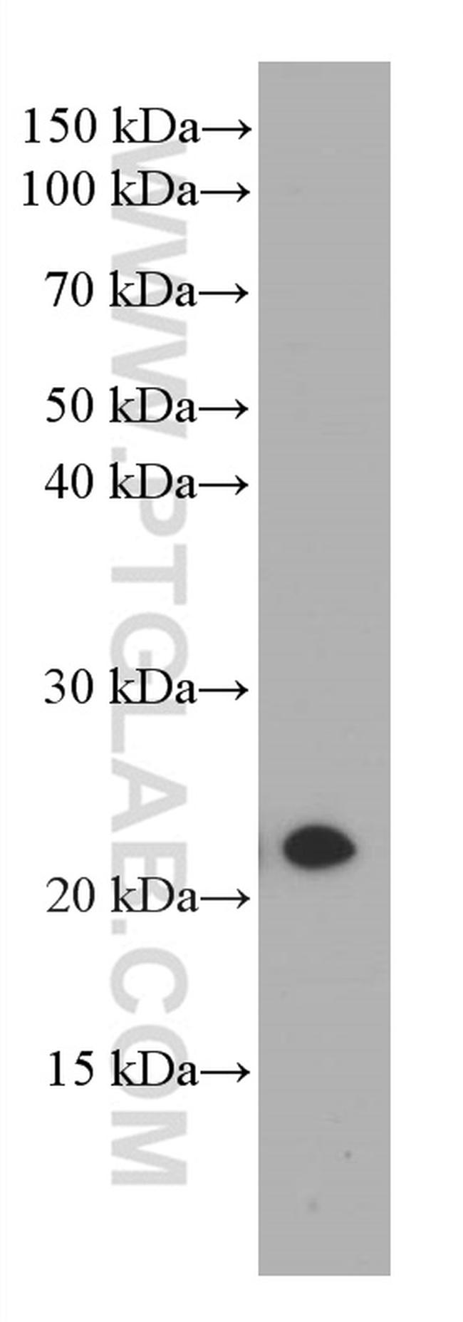 CBX3 Antibody in Western Blot (WB)