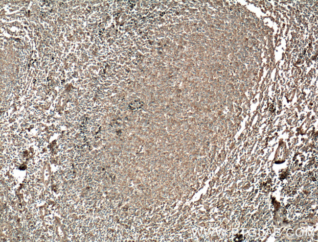 HVCN1 Antibody in Immunohistochemistry (Paraffin) (IHC (P))