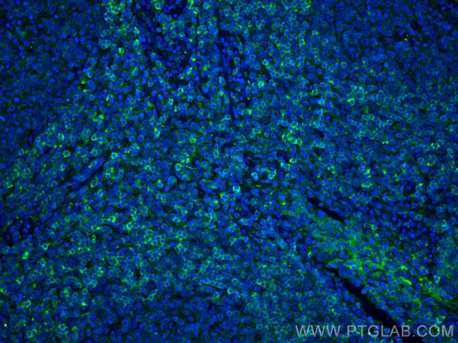 HVCN1 Antibody in Immunohistochemistry (PFA fixed) (IHC (PFA))