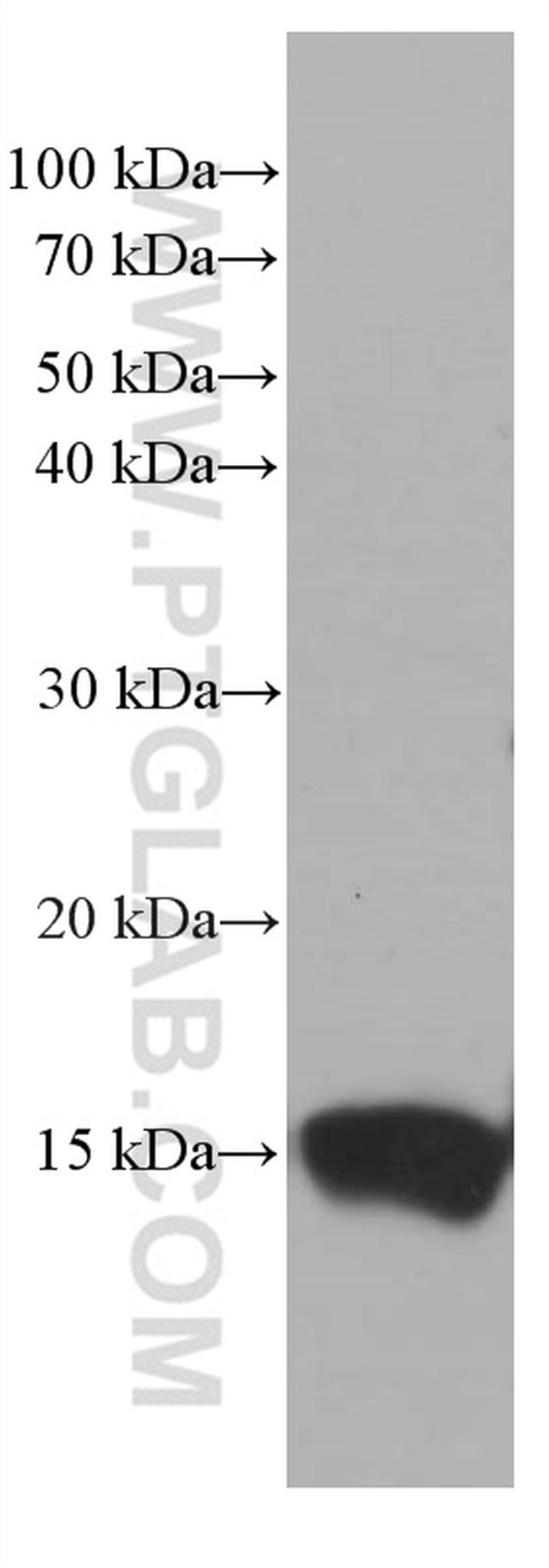 TFF2 Antibody in Western Blot (WB)