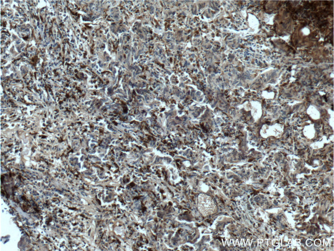 PSAP Antibody in Immunohistochemistry (Paraffin) (IHC (P))