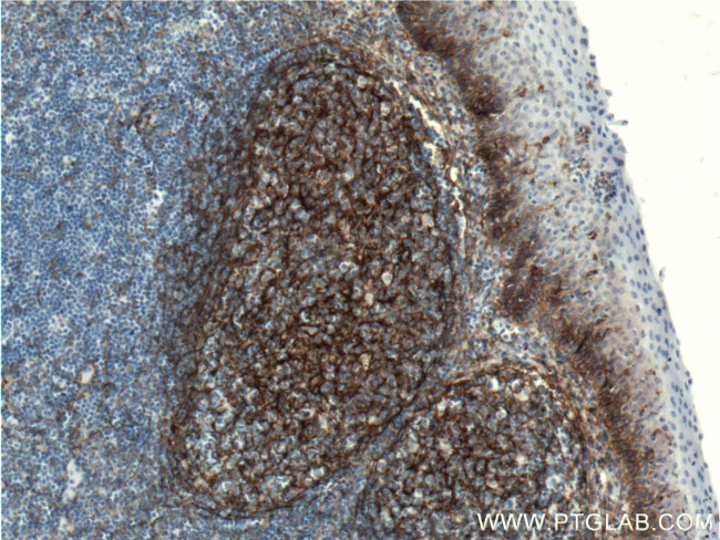 B7-H3 Antibody in Immunohistochemistry (Paraffin) (IHC (P))