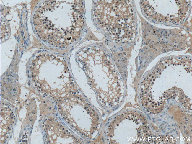 G3BP1 Antibody in Immunohistochemistry (Paraffin) (IHC (P))