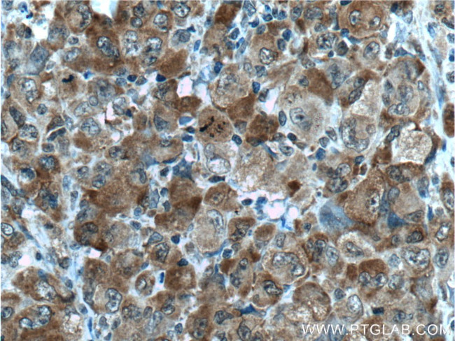 G3BP1 Antibody in Immunohistochemistry (Paraffin) (IHC (P))