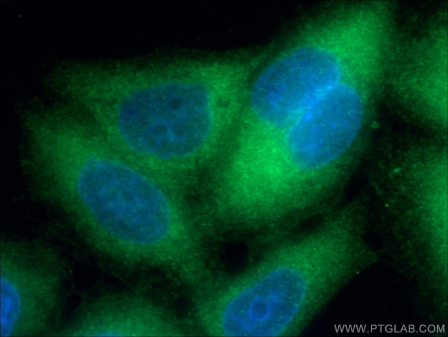 S100A4 Antibody in Immunocytochemistry (ICC/IF)