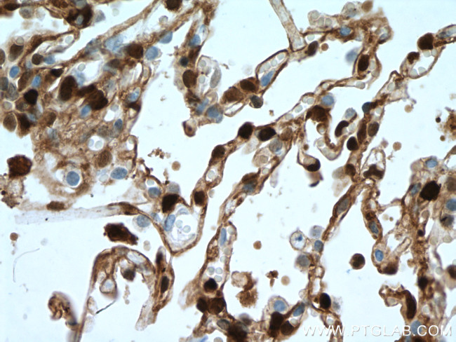 S100A4 Antibody in Immunohistochemistry (Paraffin) (IHC (P))