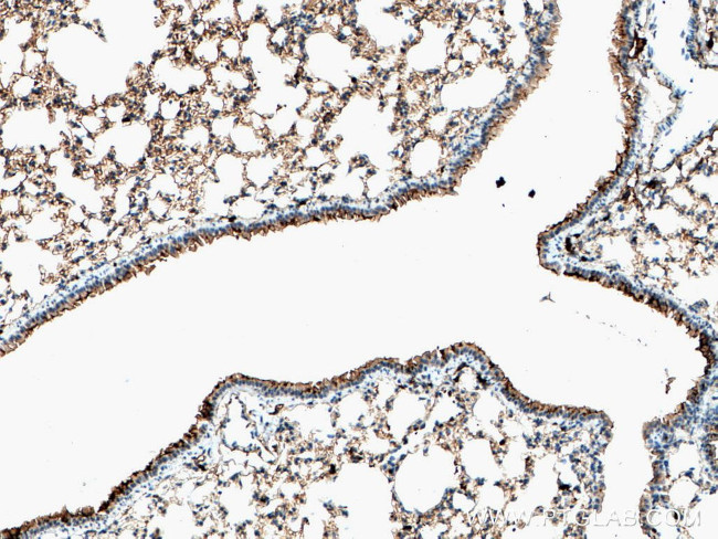 S100A4 Antibody in Immunohistochemistry (Paraffin) (IHC (P))