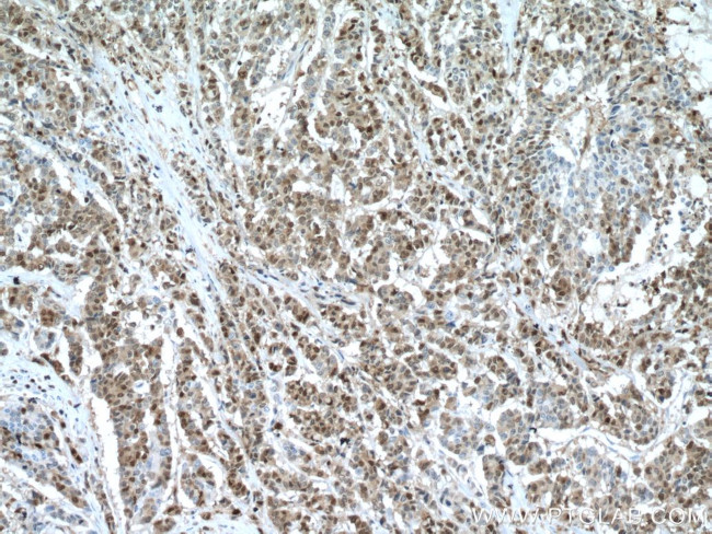 S100A4 Antibody in Immunohistochemistry (Paraffin) (IHC (P))