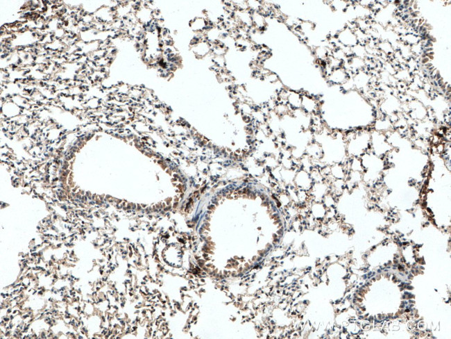 S100A4 Antibody in Immunohistochemistry (Paraffin) (IHC (P))