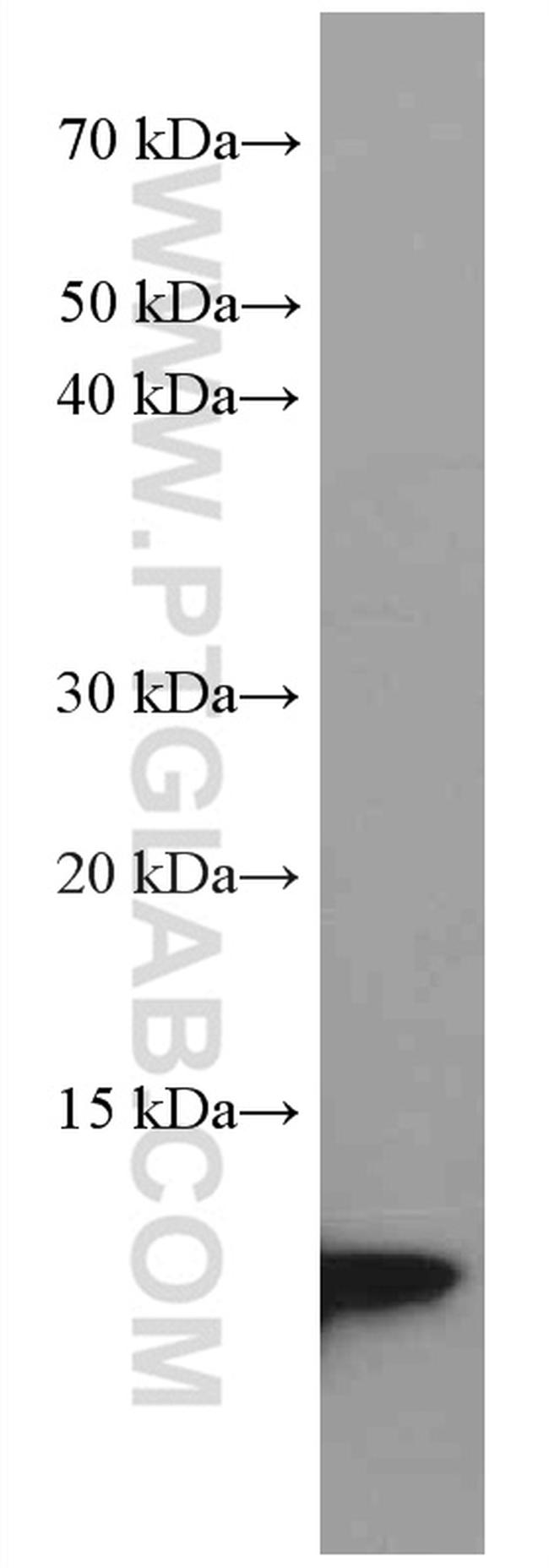 S100A4 Antibody in Western Blot (WB)