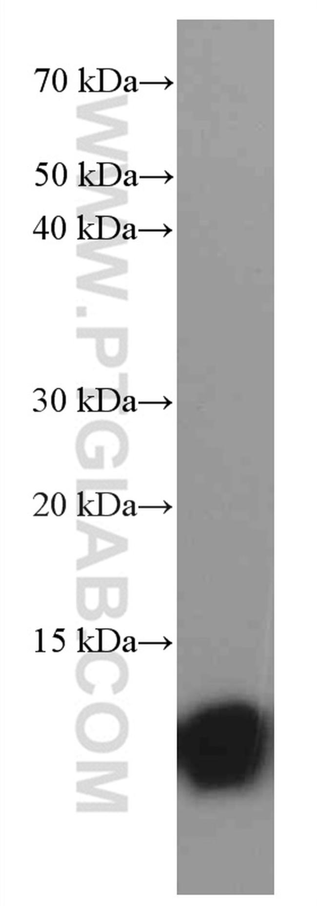 S100A4 Antibody in Western Blot (WB)