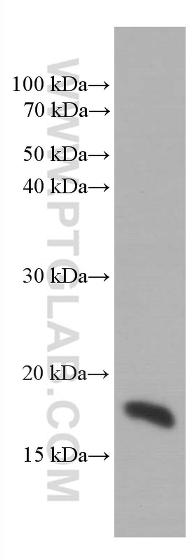 SURVIVIN Antibody in Western Blot (WB)