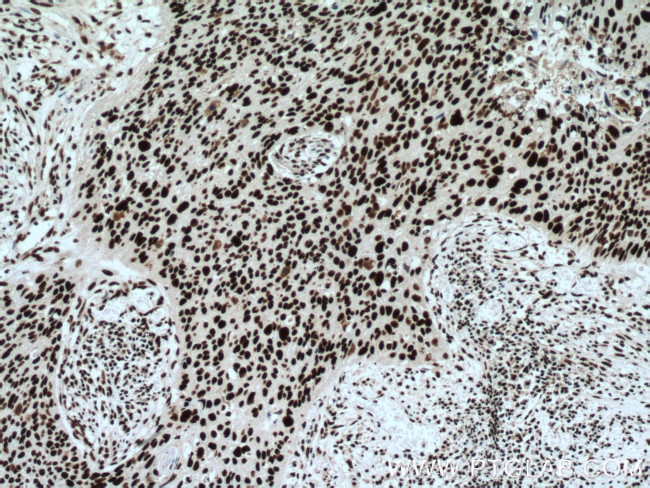 CCAR2 Antibody in Immunohistochemistry (Paraffin) (IHC (P))