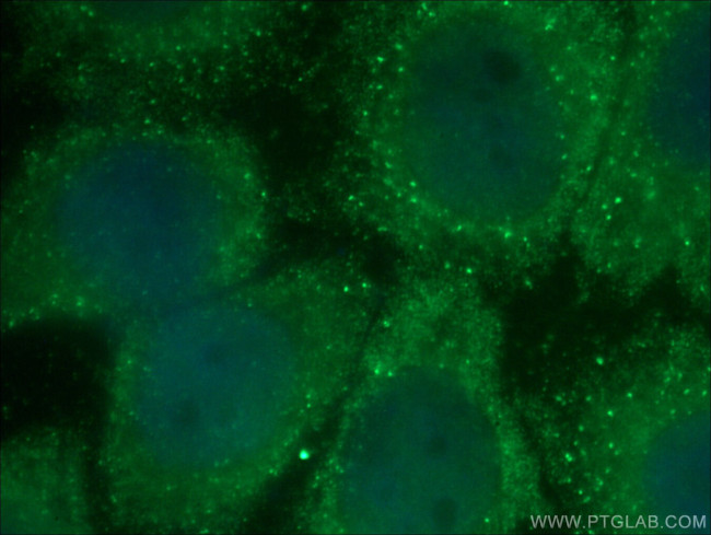 TRAF6 Antibody in Immunocytochemistry (ICC/IF)