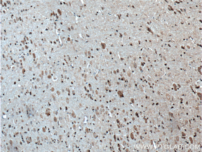 TRAF6 Antibody in Immunohistochemistry (Paraffin) (IHC (P))