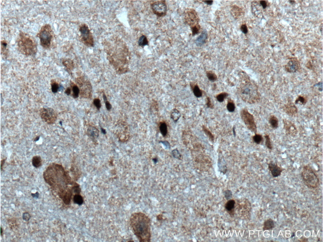 TRAF6 Antibody in Immunohistochemistry (Paraffin) (IHC (P))