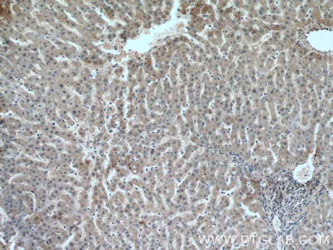 TRAF6 Antibody in Immunohistochemistry (Paraffin) (IHC (P))