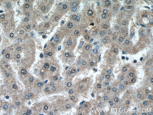 TRAF6 Antibody in Immunohistochemistry (Paraffin) (IHC (P))