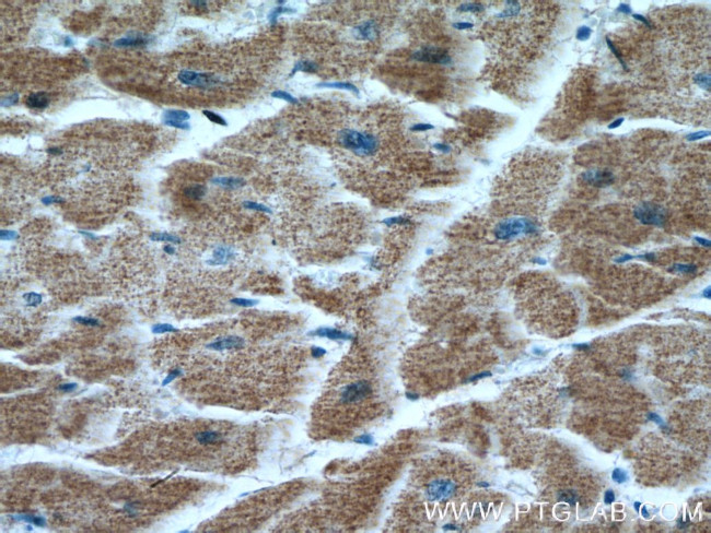 TRAF6 Antibody in Immunohistochemistry (Paraffin) (IHC (P))