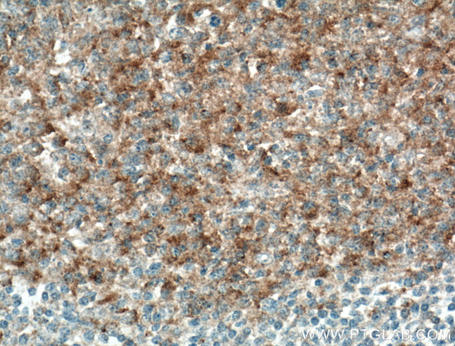 CD40L/CD154 Antibody in Immunohistochemistry (Paraffin) (IHC (P))