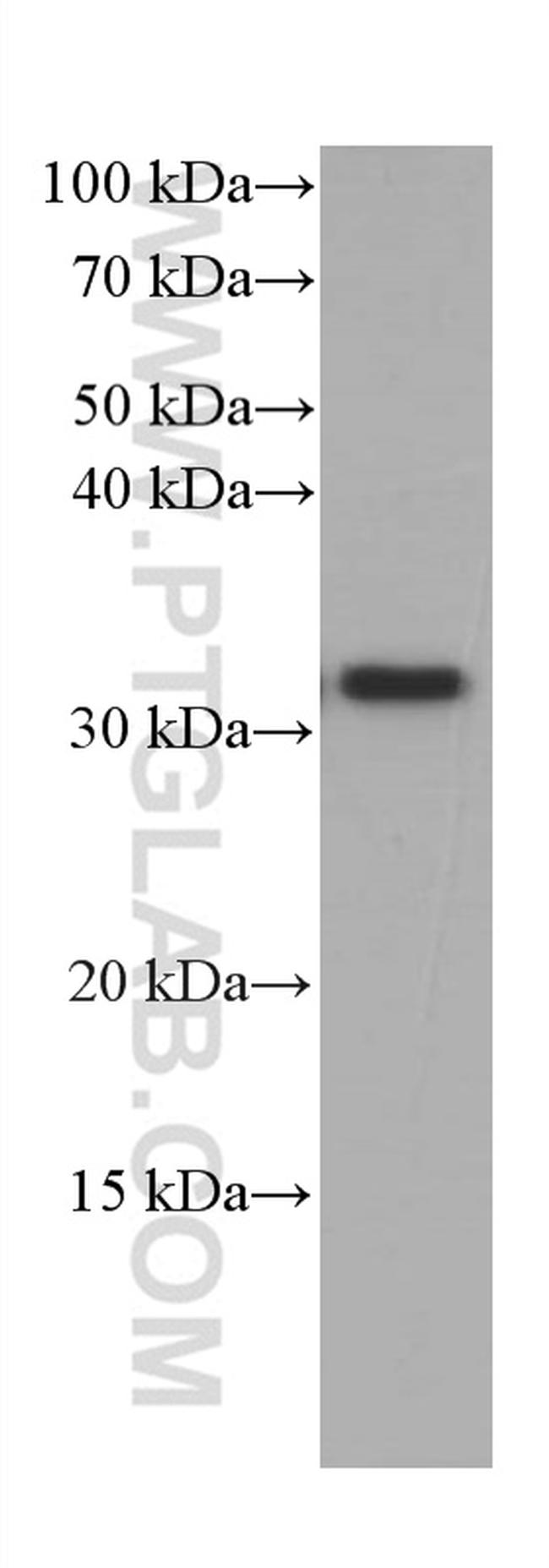 CD40L/CD154 Antibody in Western Blot (WB)