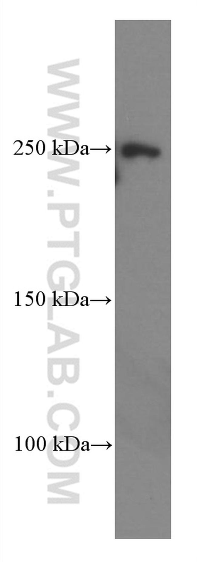 CNOT1 Antibody in Western Blot (WB)