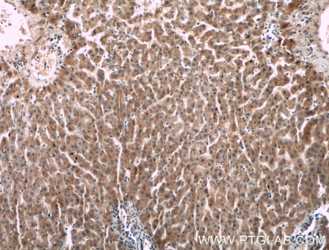 F2 Antibody in Immunohistochemistry (Paraffin) (IHC (P))