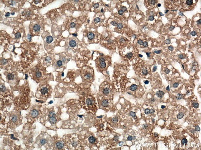 TIP47 Antibody in Immunohistochemistry (Paraffin) (IHC (P))