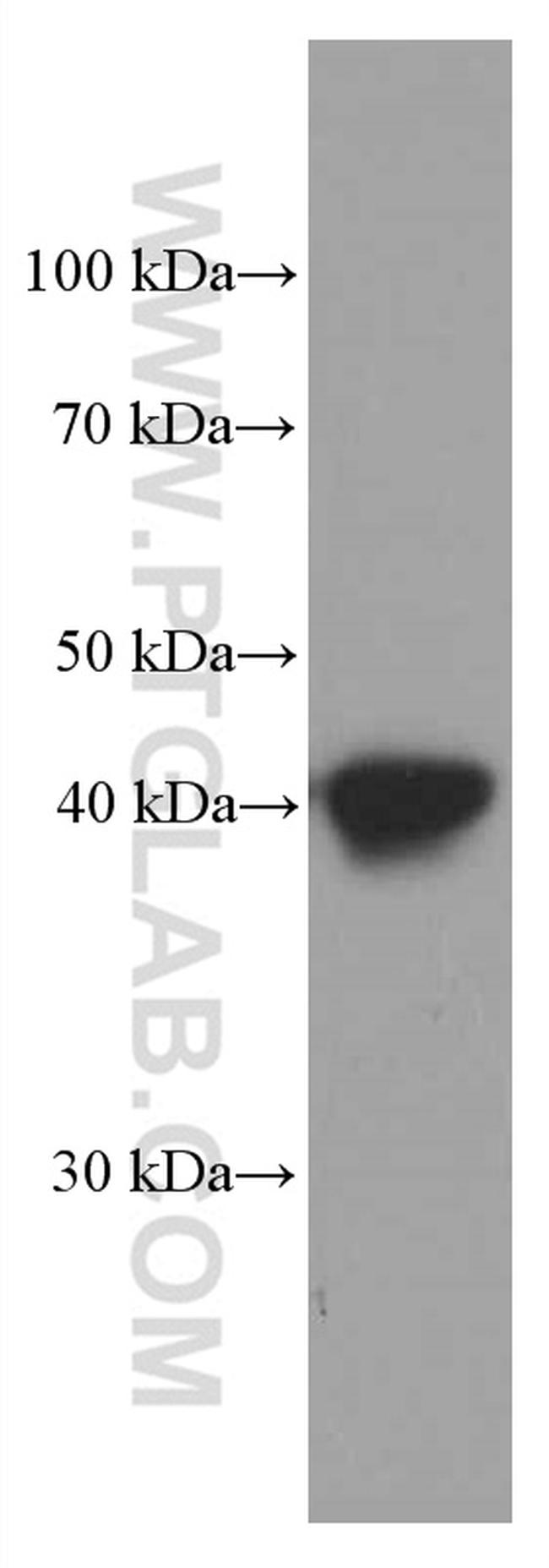 HLA-E Antibody in Western Blot (WB)