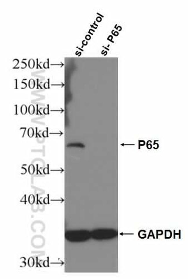 p65/RELA Antibody in Western Blot (WB)