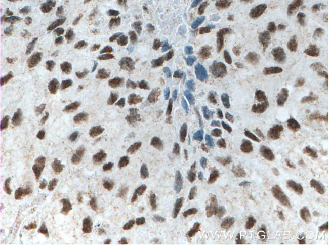 XRCC5 Antibody in Immunohistochemistry (Paraffin) (IHC (P))