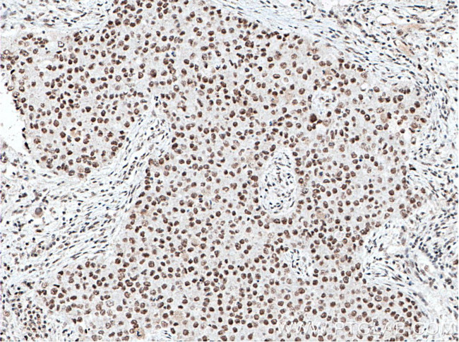 XRCC5 Antibody in Immunohistochemistry (Paraffin) (IHC (P))