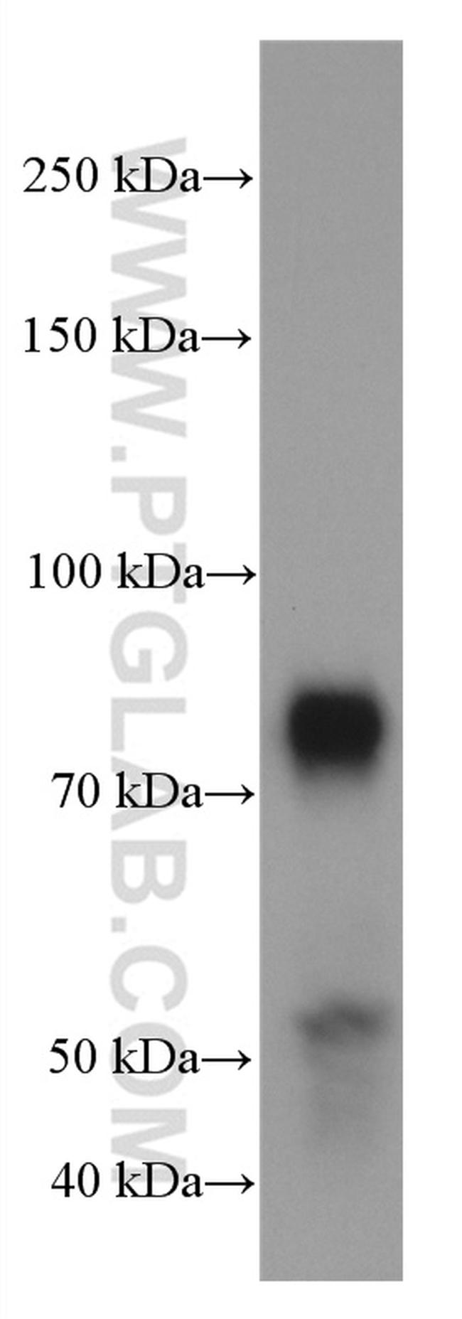 TBR1 Antibody in Western Blot (WB)