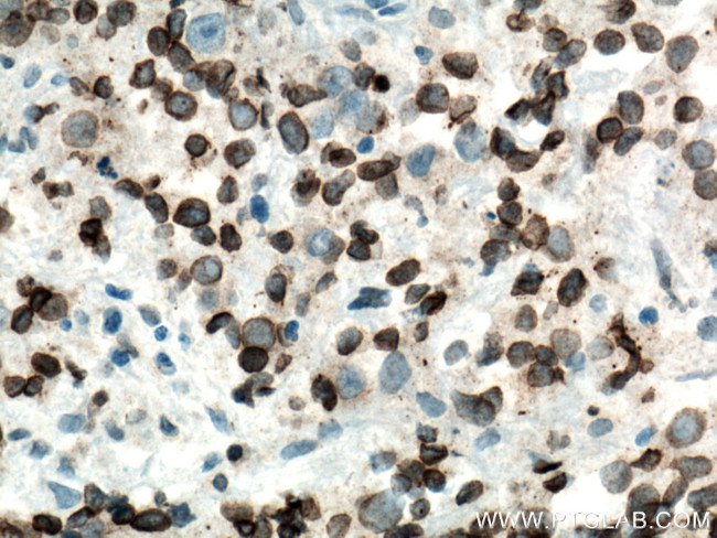 NUP62 Antibody in Immunohistochemistry (Paraffin) (IHC (P))