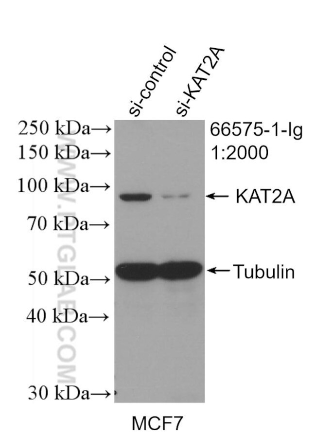 KAT2A/GNC5 Antibody in Western Blot (WB)