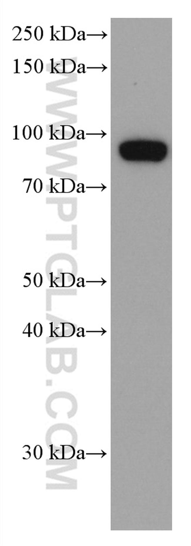 KAT2A/GNC5 Antibody in Western Blot (WB)