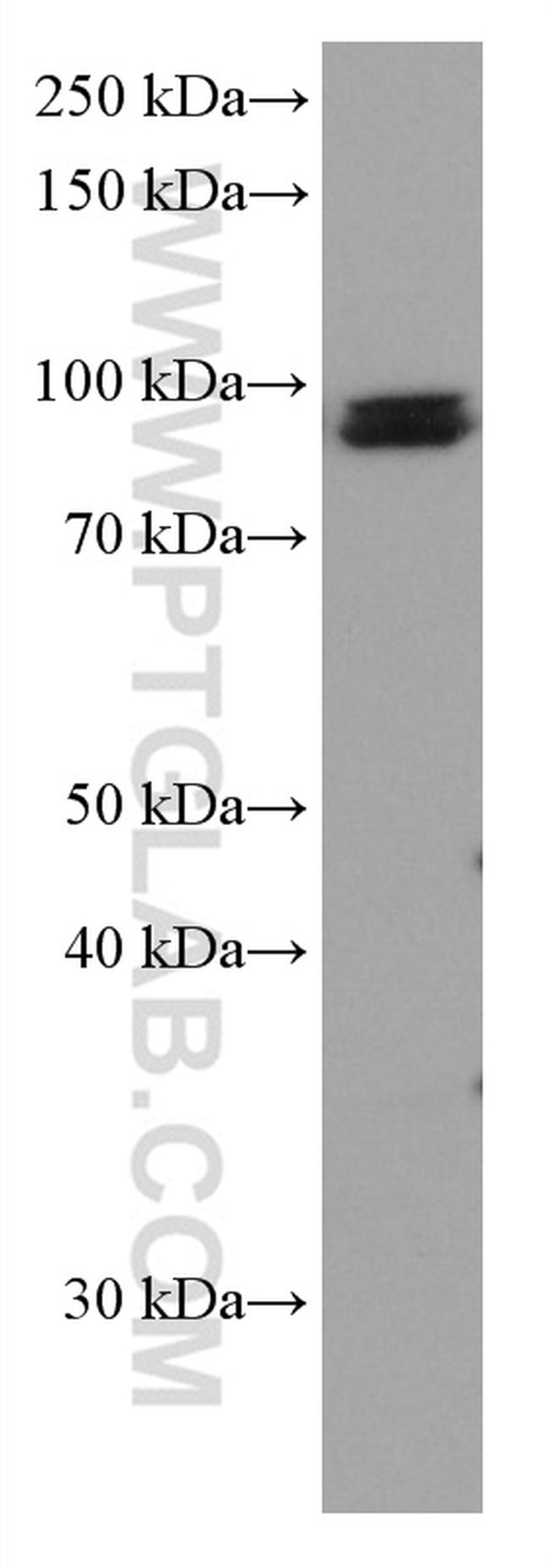 KAT2A/GNC5 Antibody in Western Blot (WB)