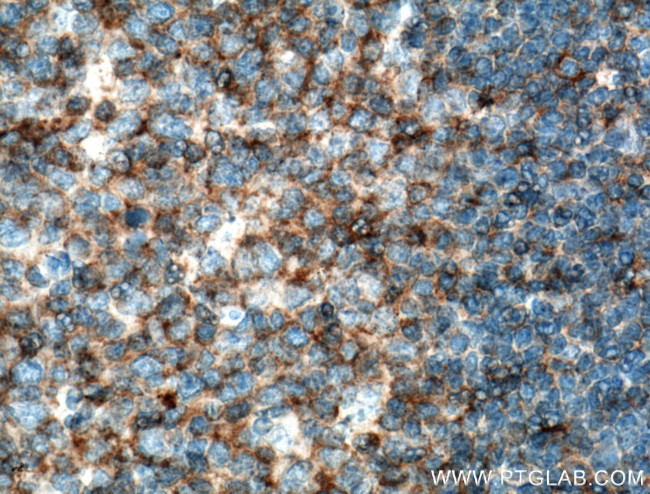 CD100 Antibody in Immunohistochemistry (Paraffin) (IHC (P))