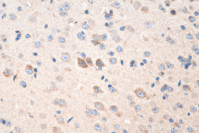 OPA1 Antibody in Immunohistochemistry (Paraffin) (IHC (P))