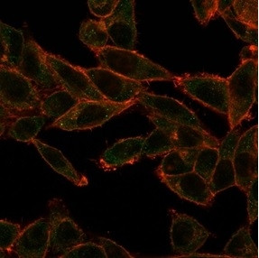 SOX4 (Master Regulator of Epithelial-Mesenchymal Transition) Antibody in Immunocytochemistry (ICC/IF)